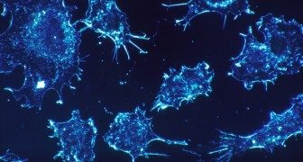 Découverte du code d'autodestruction des cellules cancéreuses : il pourrait nous aider à les éliminer de manière sélective