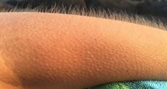 Bekommst du Gänsehaut, wenn du deine Lieblingsmusik hörst? Deshalb ist dein Gehirn laut Wissenschaft besonders