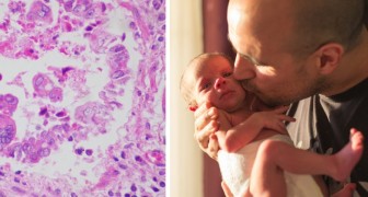 Smettiamo di baciare i neonati: con la stagione invernale aumentano i rischi di infezioni respiratorie