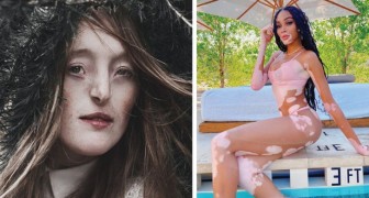 10 framgångsrika modeller som stolt visar upp sin kropp på catwalken trots att den inte passar in i den traditionella skönhetsstandarden