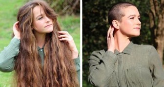 20 donne che hanno scelto di fare a meno dei capelli mostrando soddisfatte la loro liberazione