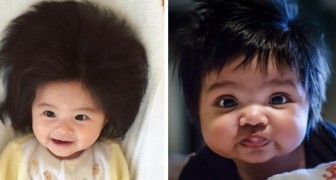 15 bilder på barn som fötts med så mycket hår att man knappt kan tro att de är äkta