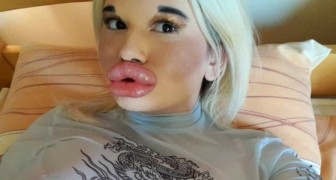 Twenty-two year old has her lips augmented in an extreme way, but wants them even bigger: on social networks they call her Barbie