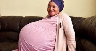 Eine 37-jährige Frau bringt 10 Zwillinge zur Welt: Es ist eine Rekordgeburt