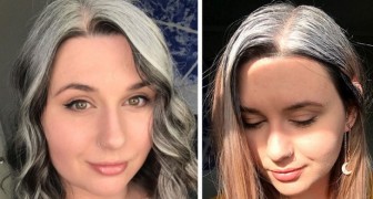 A 25 anni decide di sfoggiare con orgoglio i suoi capelli grigi: ora mi sento più sicura di me