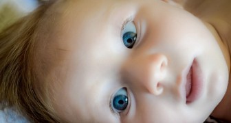 White-skinned, blue-eyed baby born to black couple