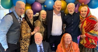 I den här familjen är alla 6 syskonen albinos
