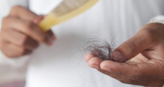 Alopezie: Was ist das, warum tritt sie auf und wie kann man die Krankheit, die Haarausfall verursacht, behandeln?