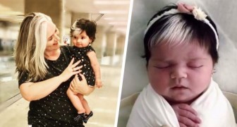 Babyn föddes med samma vita hårlock som sin mor: en egenskap som gör henne unik