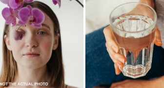 I am allergic to water: I cannot drink it or even cry without having a reaction