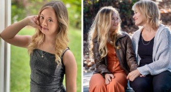 Ze weigert haar dochter met het syndroom van Down toe te vertrouwen aan een instelling: het meisje wordt model