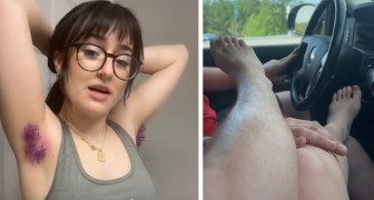 Young woman is proud of her leg and armpit hair: My boyfriend loves it