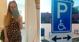 Woman uses the disabled parking but is criticized for looking perfectly healthy: Many disabilities are invisible!