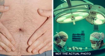 33-jähriger Mann klagt jeden Monat über Bauchschmerzen: Er findet heraus, dass er Eierstöcke und einen Uterus hat