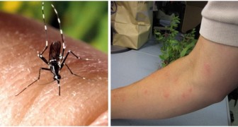 Probeer muggensteken te voorkomen met deze 5 doe-het-zelf-methoden