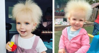 La petite fille aux cheveux rebelles : une condition très rare a fait d'elle une petite star des réseaux sociaux