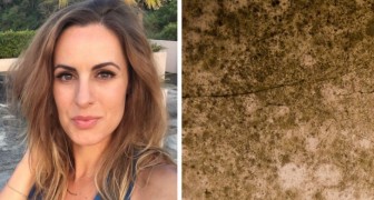 Woman suddenly gets Alzheimer's at age 37: the cause was mold in the house