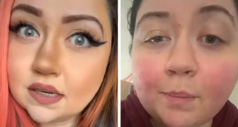 Une femme de 28 ans découvre qu'elle est allergique à la gravité : elle ne peut pas sortir du lit pendant plus de trois minutes