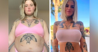 Woman sheds unwanted weight thanks to surgery and exercising: I'm wearing a bikini for the first time in my life