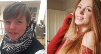 Vorher und nachher: 16 Menschen, die sich auf verblüffende Weise verändert haben