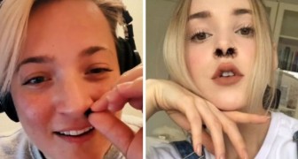 Anbringen von Nasenhaarverlängerungen: die bizarre und kontroverse Mode, die in den sozialen Medien entstanden ist