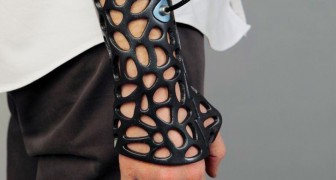 Das ist nicht der Arm eines Suoerhelden, sondern ein Gips in 3D-Druck... mit Superkräften