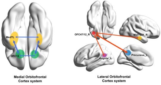 Lo studio, condotto su 1000 persone, ha mostrato che la depressione interessa la parte laterale della corteccia orbitofrontale del cervello, quella implicata nei meccanismi di ricompensa.