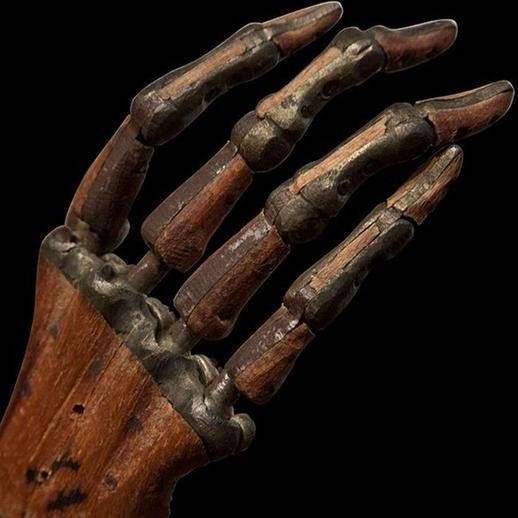 12. Eine Handprothese, 19. Jahrhundert.