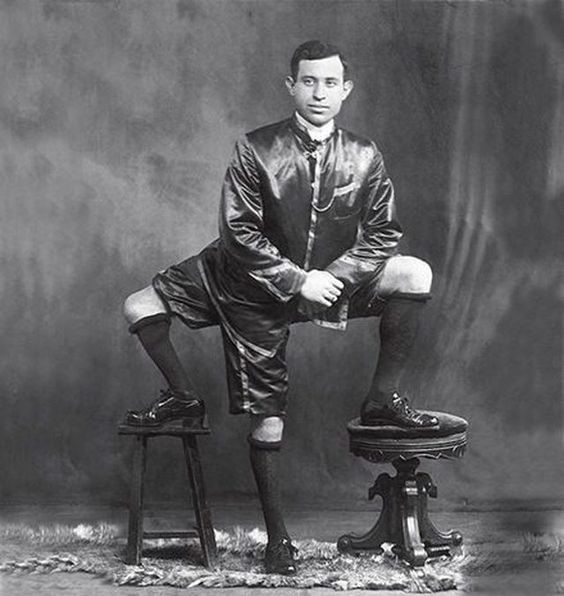 Francis « Frank » Lentini était un immigrant italien en Amérique, qui est devenu populaire pour avoir trois jambes, quatre pieds (avec doigts !) et deux organes sexuels masculins opérationnels.