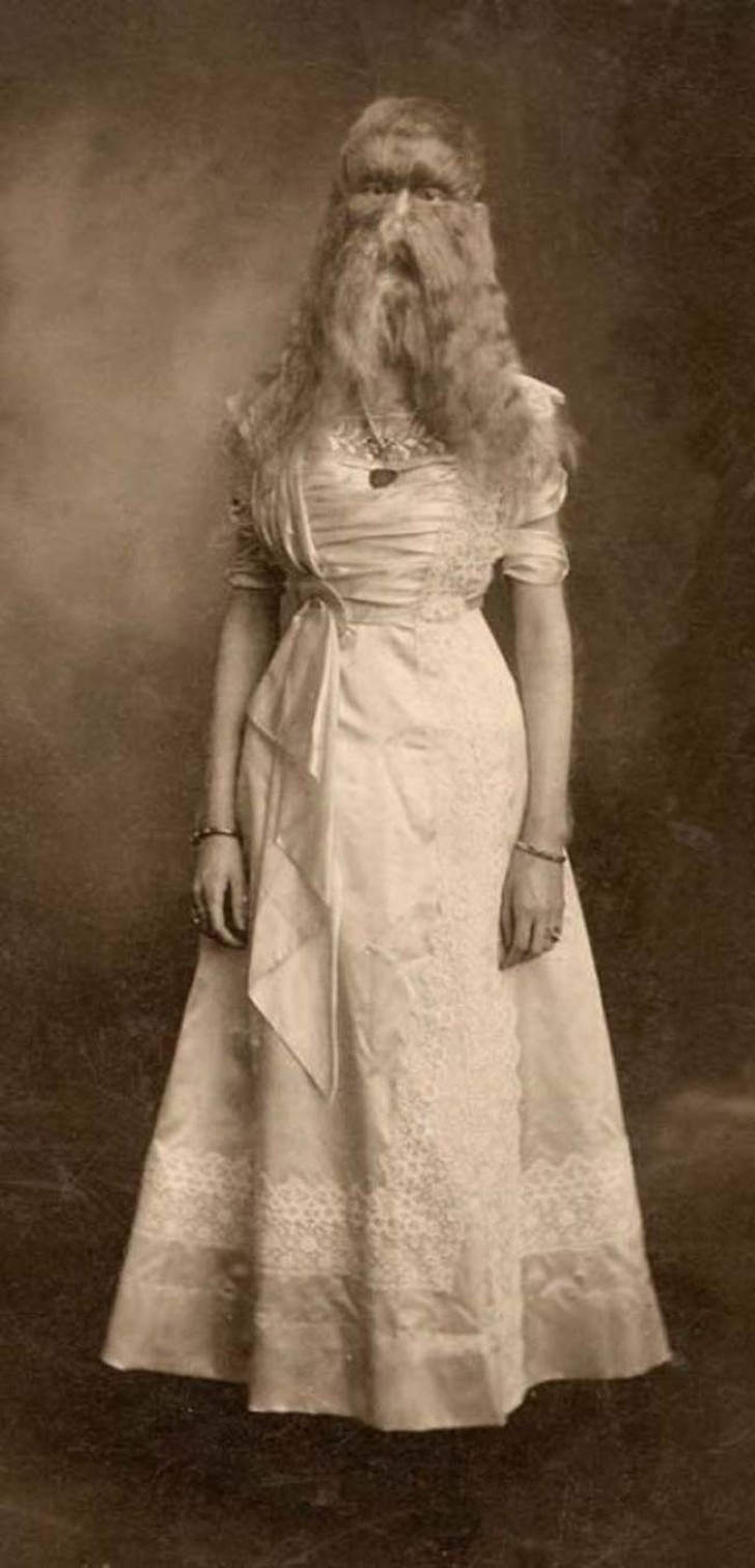 Alice Doherty, ein Mädchen aus Minnesota wurde auch "Mädchen aus Wolle" genannt.