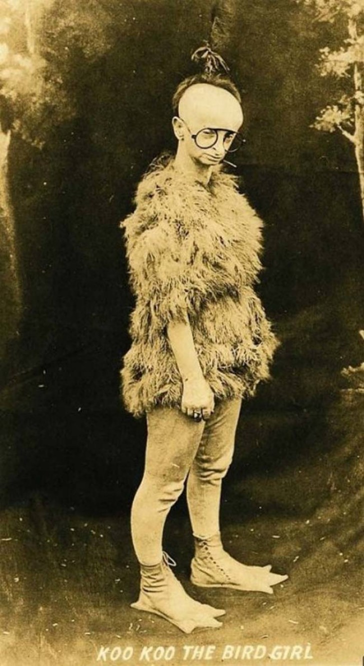 Minnie Woolsey war von Zwergwuchs betroffen. Unterlagen zeigen dass sie bis 1960 an Freakshows teilnahm. Zu dem Zeitpunkt war sie schon 80 Jahre alt.
