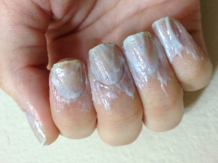 Stained and yellowed nails can be made clean and bright white again with toothpaste!