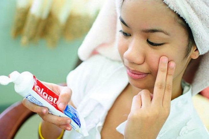 Tandpasta heeft een gunstige invloed op mee-eters en acne.