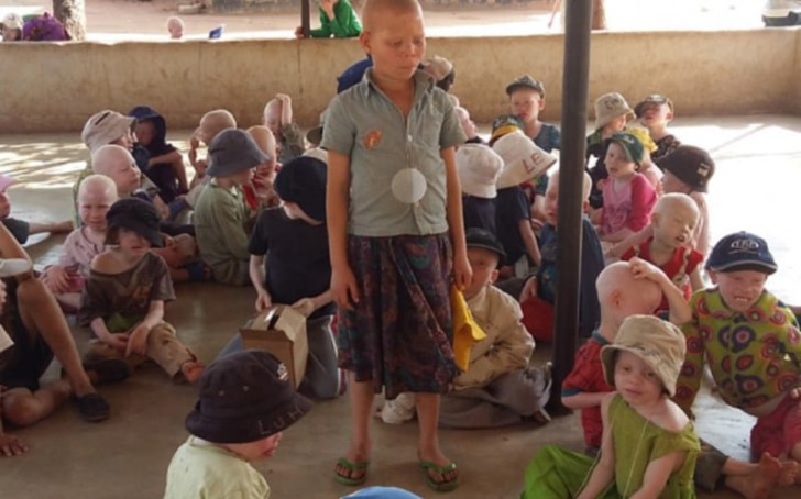 Soltanto poche decine di persone sono state condannate per aver partecipato al traffico illegale di albini. Nel frattempo l'uccisione di bambini e la loro mutilazione proseguono inarrestabili.