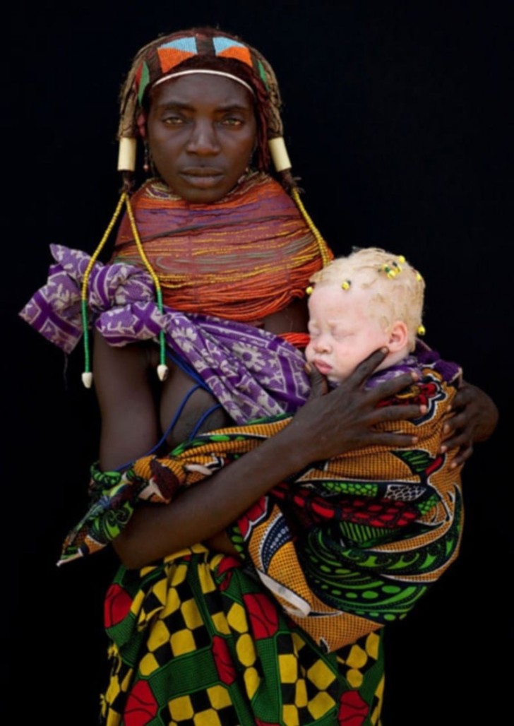 L'alto prezzo del corpo di un albino testimonia che anche le classi politiche e quelle più ricche sono coinvolte nella caccia e nel commercio di albini.