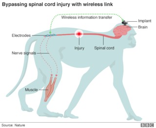Due scimmie macaco sono tornate a muoversi a seguito di una paralisi parziale. Come è stato possibile?