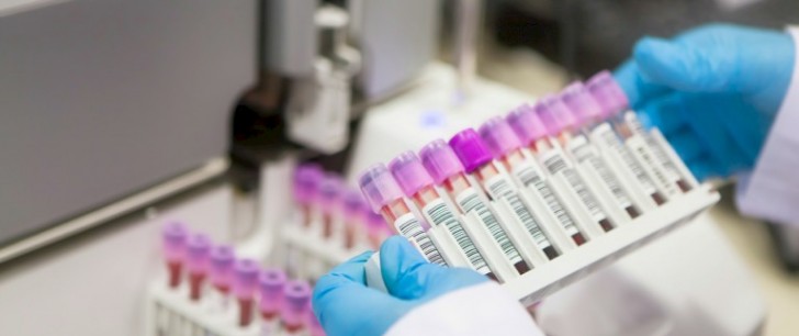 Il nuovo test si chiama SCED e garantisce la diagnosi precoce di oltre 100 tipi di cancro.