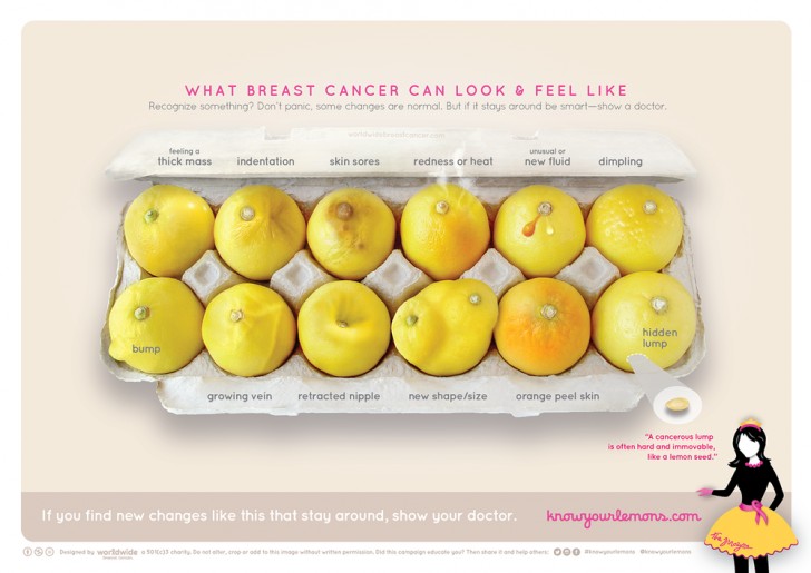 Les 12 citrons: cette image montre comment le cancer du sein peut se manifester.