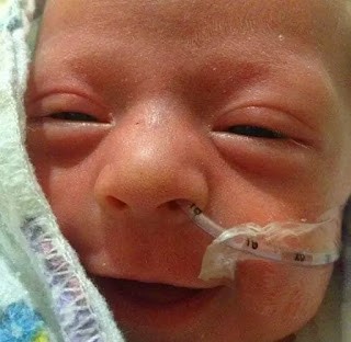 Même s'il ne pesait que 907 grammes (moins d'un 1 kg!), ce bébé a ouvert ses yeux en saluant ainsi le monde qui l'entoure.