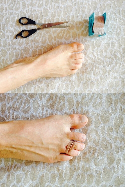 3. If you wear heels, bind the second and third toe together with medical tape. This will help avoid and eliminate pain in the front part of the foot.