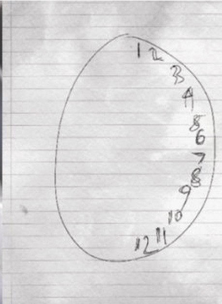 As the result of a standard psychiatric test, Dr. Najjar understood in a few minutes what was happening to Susannah.