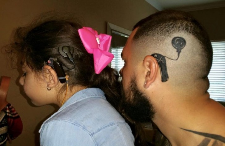 Een vader heeft een tatoeage van een gehoorimplantaat laten zetten zodat zijn dochtertje zich niet anders zou voelen dan de rest.