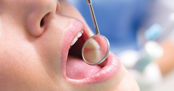 5. Empfindliches und blutendes Zahnfleisch