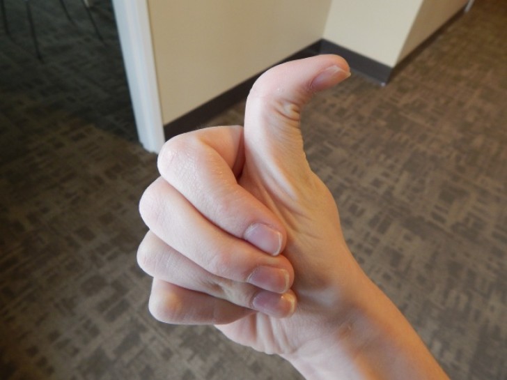 9. Hitchhiker's thumb.