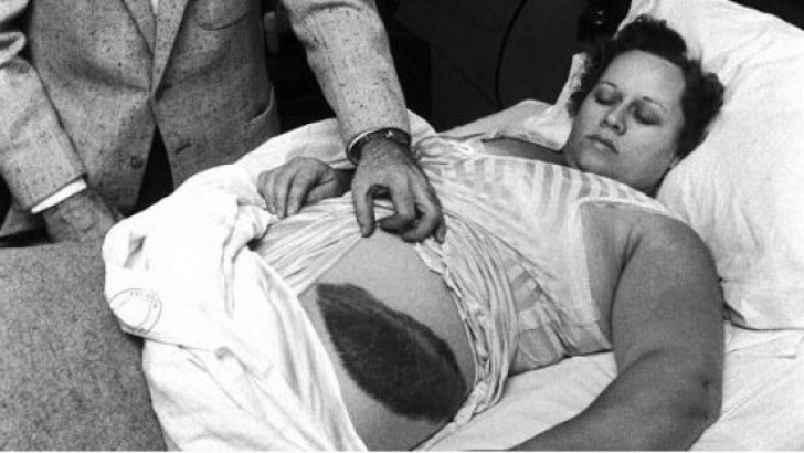 14. Anna Hodges è l'unica donna ad essere sopravvissuta dopo essere stata colpita da un meteorite.