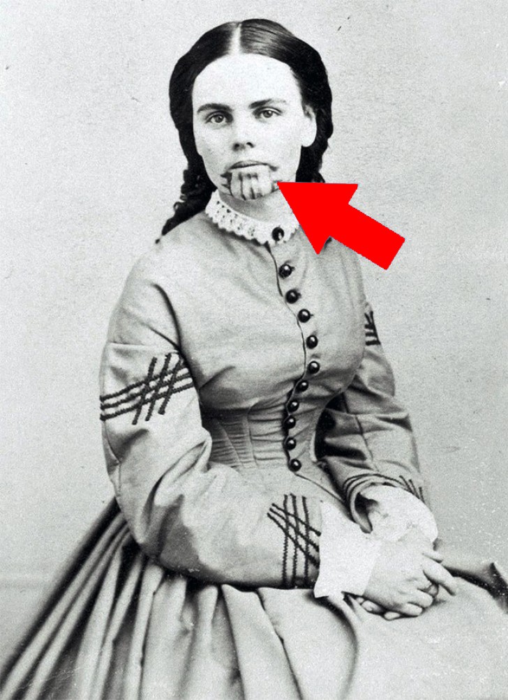 2. A white woman with an Indian tattoo in 1863.