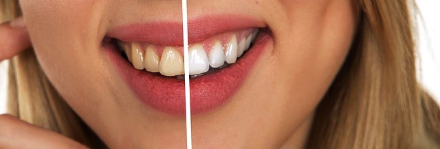 7. Cura dentale