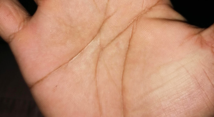 Il palmo di una mano destra mostra le linee a dorma di M