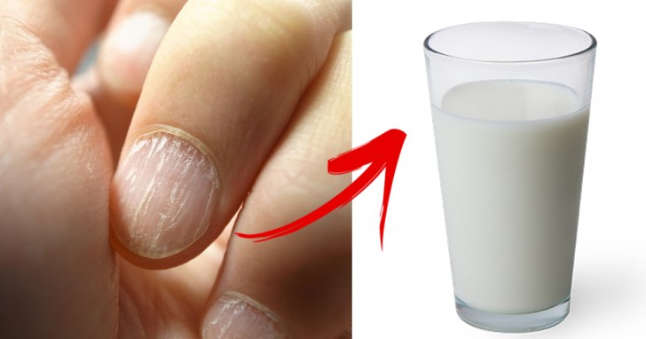 6. Uñas y cabellos fragiles.