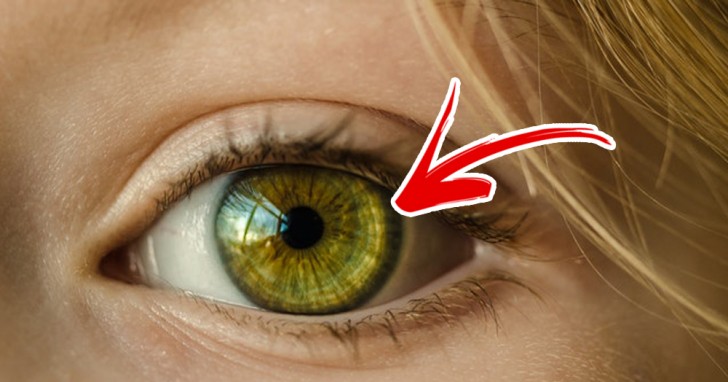 7. Rings around the iris of the eyes